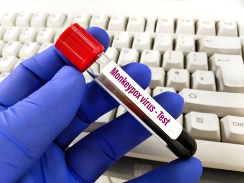 Monkeypox
